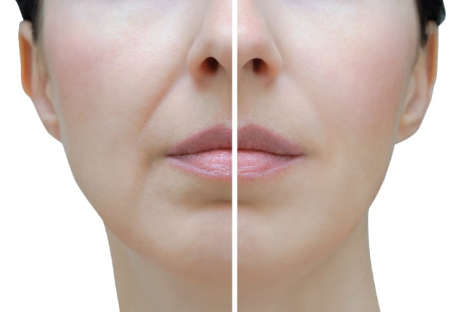 lineup-model line up mask