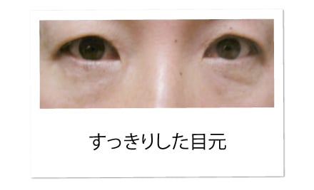 eye